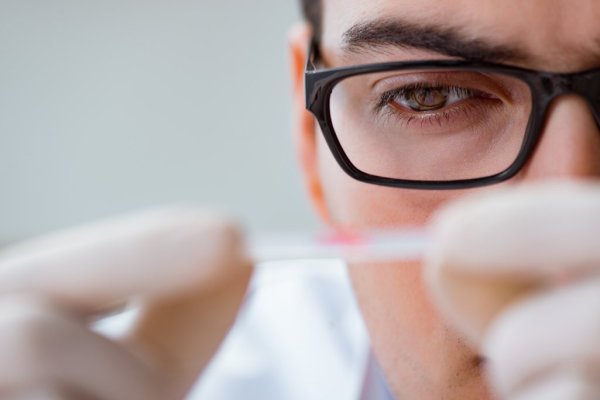 Do you need to do vitamin D concentration test to know if you are missing? Latest official guidance answers