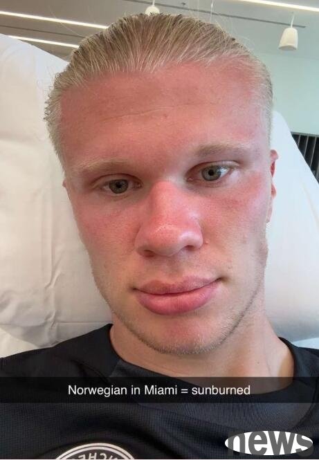 �Liu Haaland posted photos to prepare for the Club World Cup: Norwegians are in Miami and are sunburned!