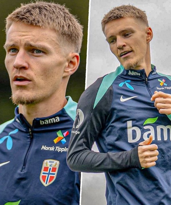 There is no hair to pull 😂Arsenal & Norwegian captain Odegao went to the national team to change his new hairstyle